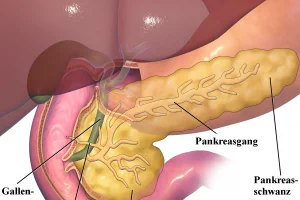 Als exokrine Pankreasinsuffizienz (kurz EPI genannt) bezeichnet man eine Erkrankung der Bauchspeicheldrüse, die eine ungenügende Menge Verdauungsenzyme produziert.