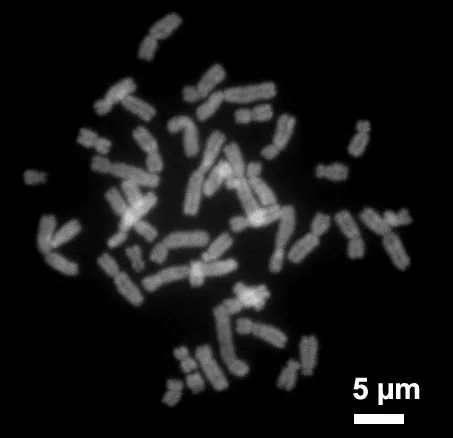 Chromosom – Wikipedia
